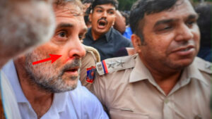 Rahul Gandhi Arrest: పోలీసుల అత్యుత్సాహం.. రాహుల్ గాంధీకి గాయాలు, ముక్కు నుండి కారిన రక్తం…వీడియో వైరల్