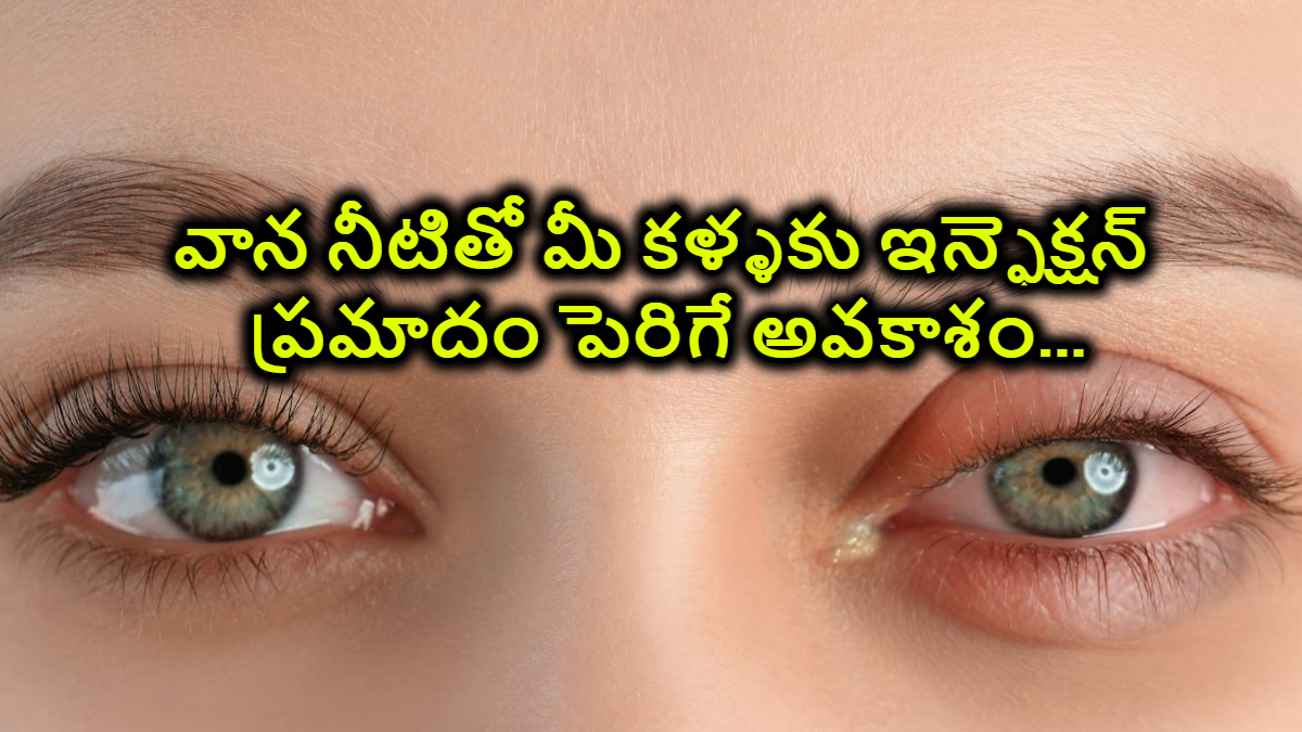 వాన నీటితో మీ కళ్ళకు ఇన్ఫెక్షన్ ప్రమాదం పెరిగే అవకాశం…తీసుకోవాల్సిన జాగ్రత్తలు ఇవే..