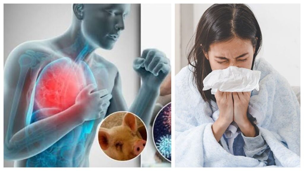 Swine Flu Alert: H1N1 కేసులు కలకలం.. దేశ రాజధానిలో ఆరు రెట్లు పెరిగిన స్వైన్ ఫ్లూ కేసులు.. తీసుకోవాల్సిన జాగ్రత్తలు ఇవే..