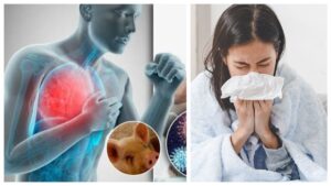 Swine Flu Alert: H1N1 కేసులు కలకలం.. దేశ రాజధానిలో ఆరు రెట్లు పెరిగిన స్వైన్ ఫ్లూ కేసులు.. తీసుకోవాల్సిన జాగ్రత్తలు ఇవే..